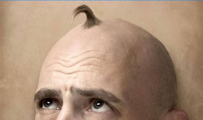Anti skaldethed for mænd
