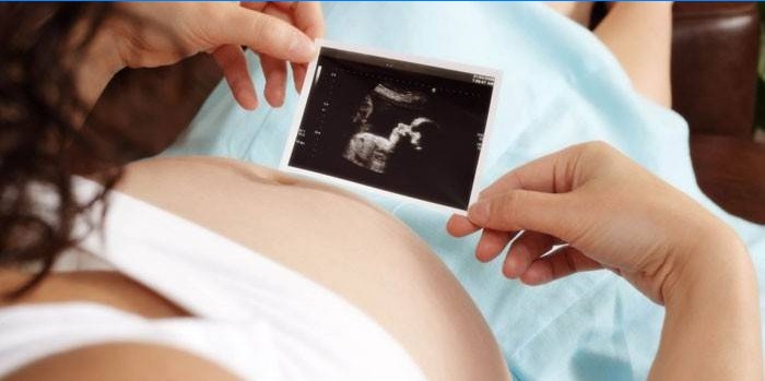 Gravid kvinde ser på ultralydscanning