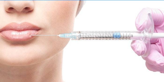 Kvinde får Botox-injektion på læberne