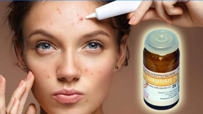 Acne salicylsyre