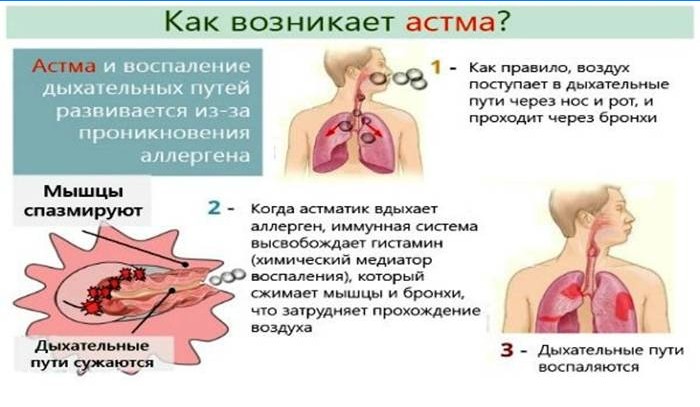 Hvordan forekommer astma?