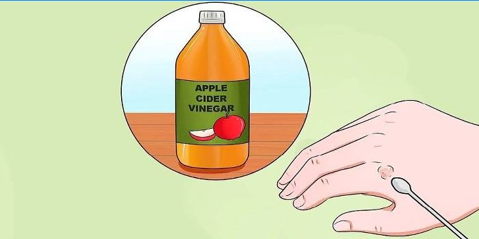 Æble cider eddike